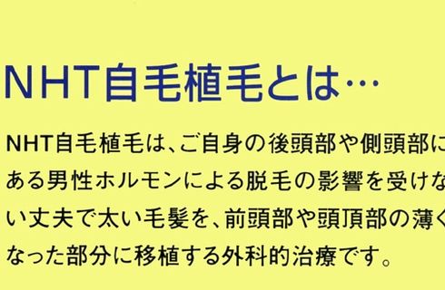 NHT式自毛植毛
