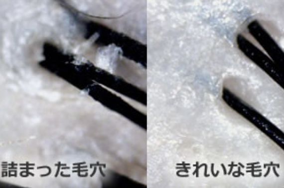 【頭皮加齢臭ケア】君津木更津市の理美容室エンゼルヘアサロンがおすすめと人気です！